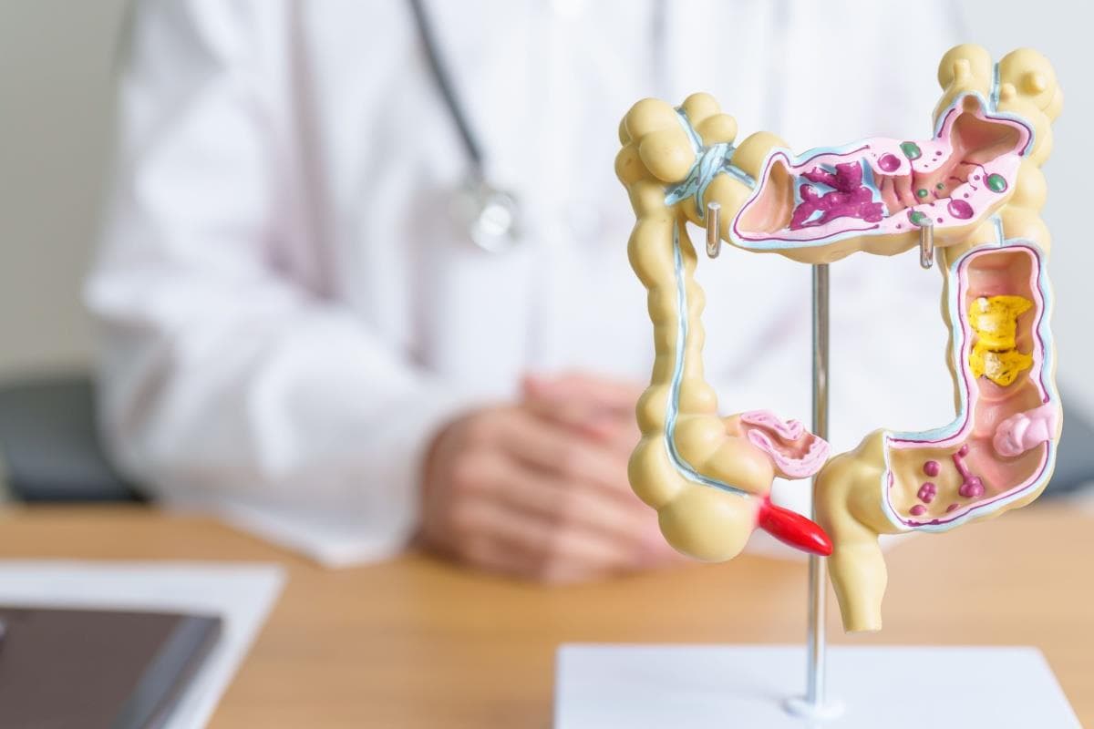 Megacolon congenital (boala Hirschsprung): cauze, simptome și opțiuni de tratament