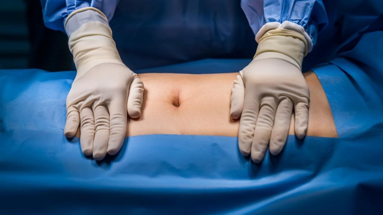 Hernia epigastrică: cauze, simptome, tratament, recuperare