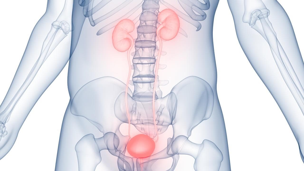 Prostatectomie: evaluare, pregătire , complicații , recuperare