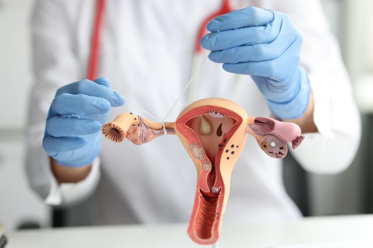 Trompe uterine înfundate (obstrucție tubară): cauze, simptome, diagnosticare și tratament