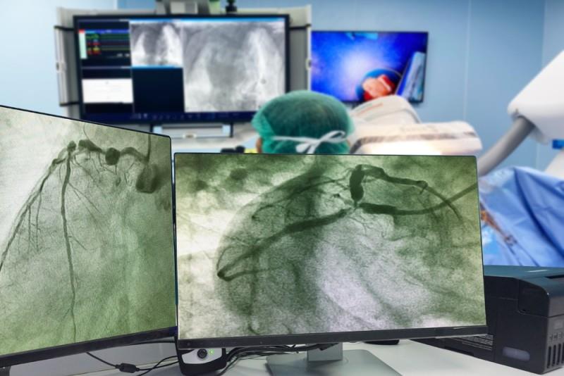 Ce analize sunt necesare înainte de o angiografie la Memorial România? Ghid practic pentru pacienți