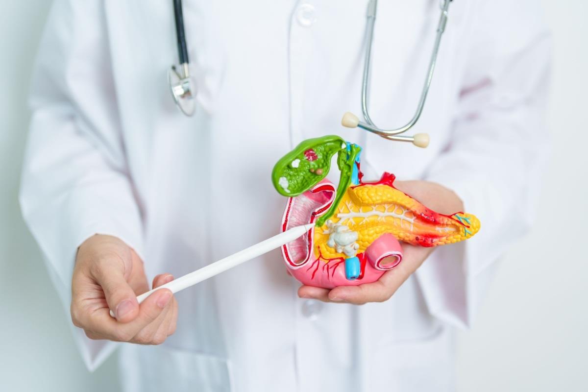 Cancerul căilor biliare (Colangiocarcinom): cauze, simptome și opțiuni de tratament