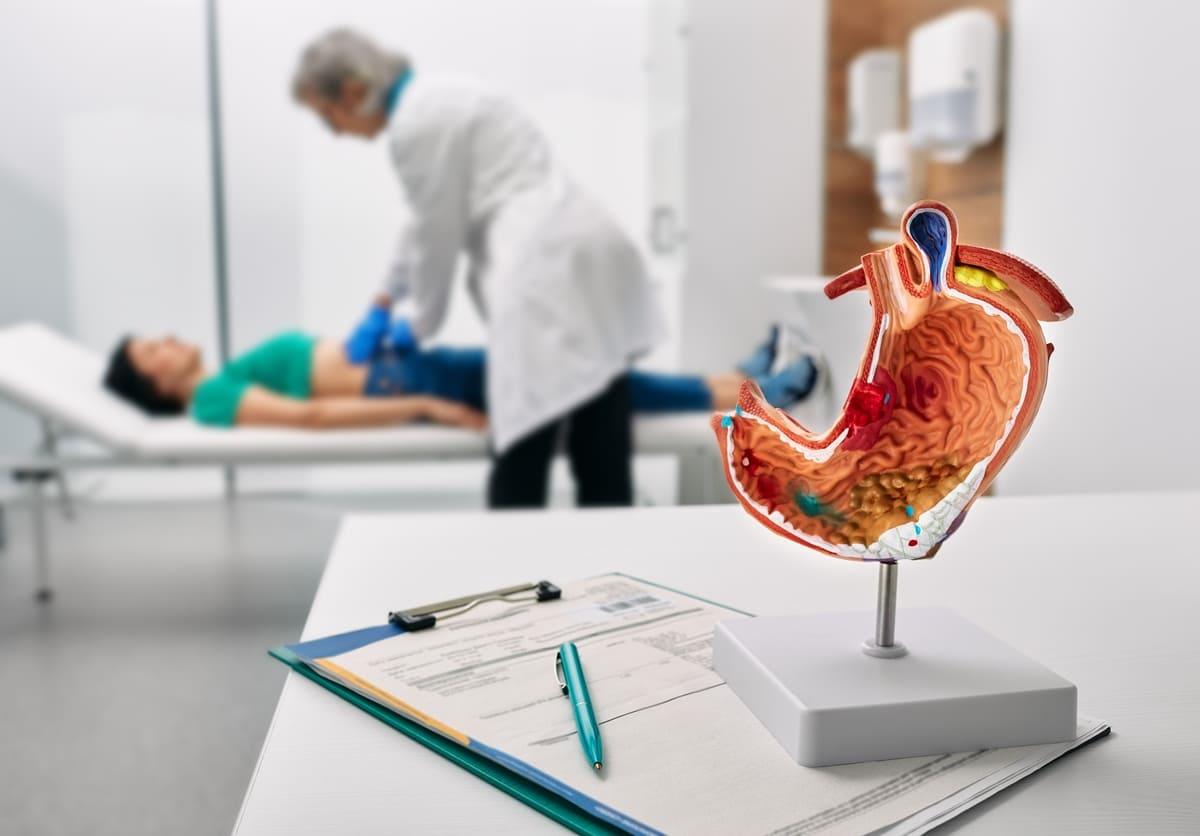 Plicatura gastrică: ce trebuie să știi despre aceasta