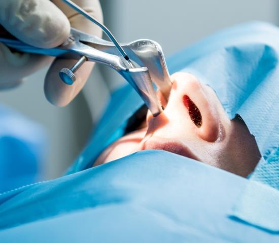 Cancerul rino-sinusal sau nazal, tratamentul chirugical prin metode moderne
