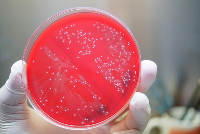 Infecția cu stafilococ auriu: cauze, simptome, diagnosticare și opțiuni de tratament