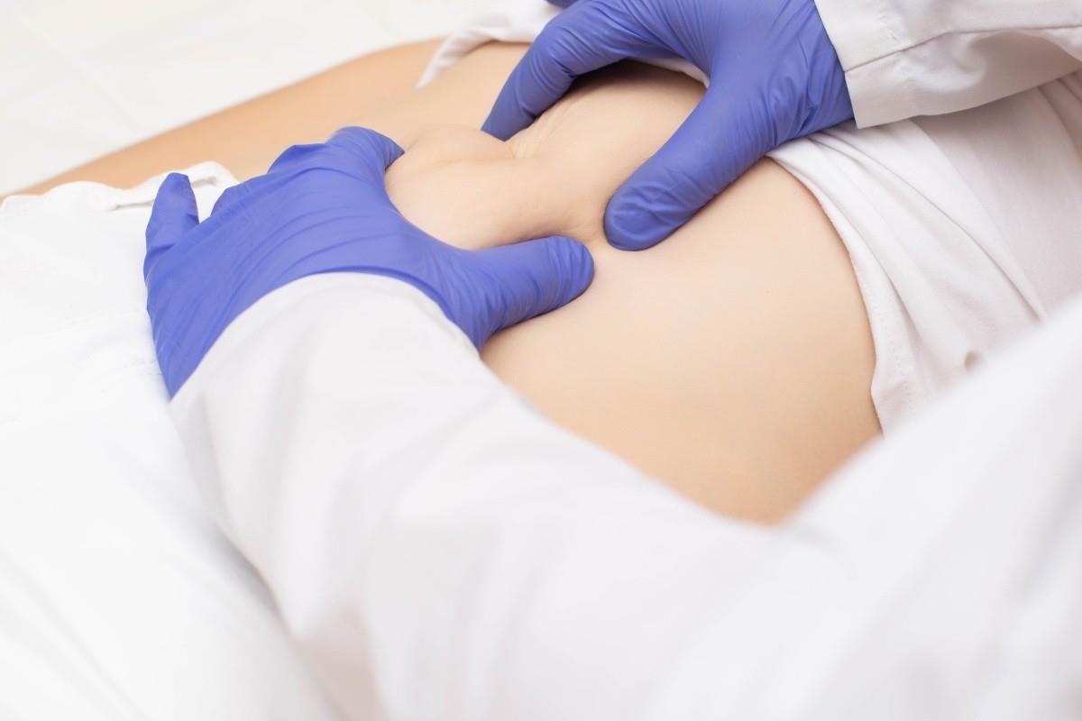 Hernia hiatală: cauze, simptome, diagnosticare și opțiuni de tratament