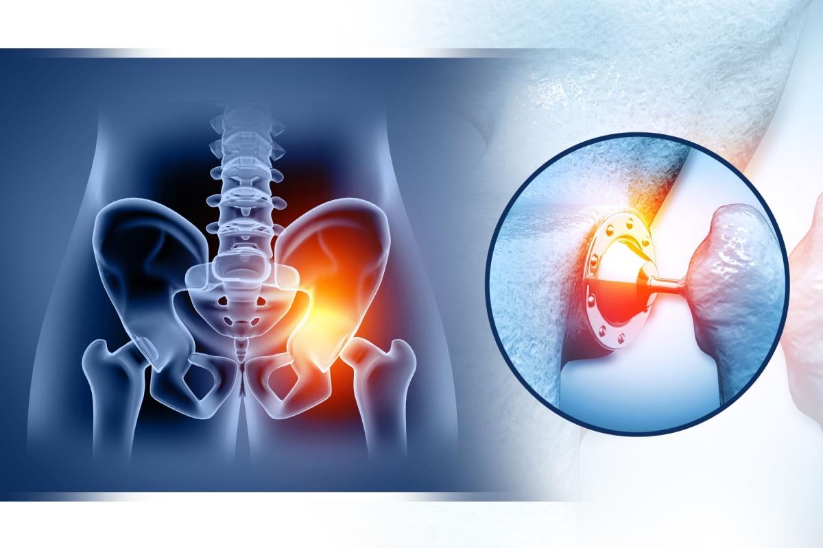 Artroplastia: tipuri, cauze, operații, recuperare