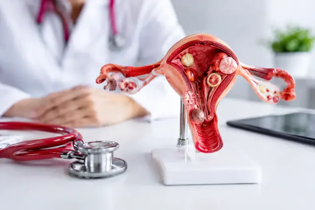 Opțiuni moderne pentru fibrom uterin explicate