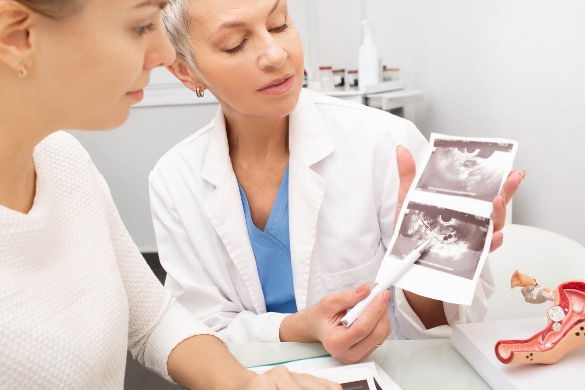 Prolaps uterin: cauze, simptome, diagnosticare și opțiuni de tratament