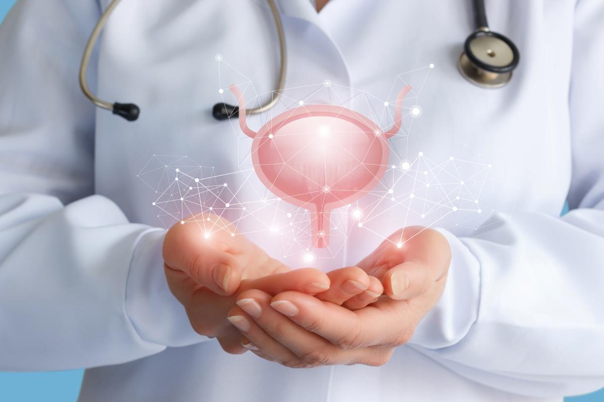 Cancer vezică urinară: simptome, cauze, riscuri, tratament chirurgical minim-invaziv
