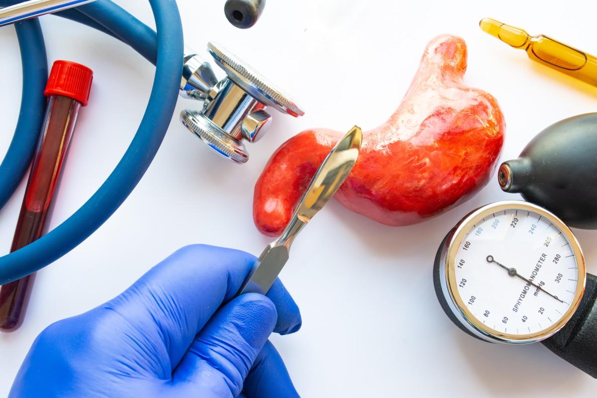 Operaţie de micșoare stomac (gastric sleeve): avantaje şi dezavantaje