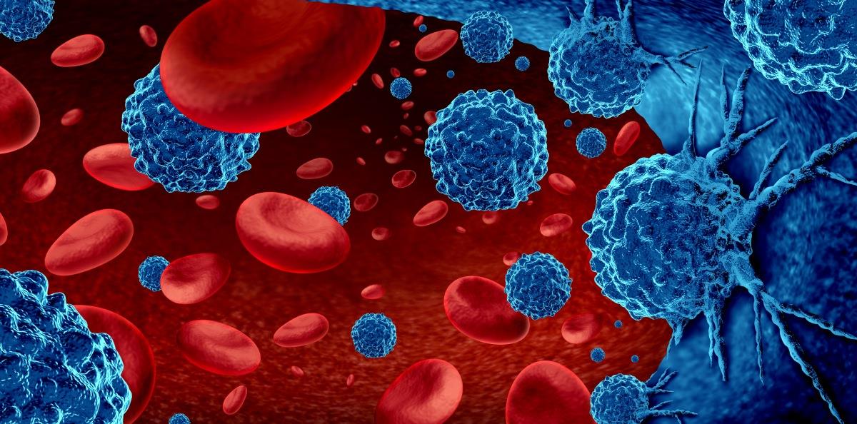 Scorul de calciu coronarian, o investigatie ce poate salva vieti