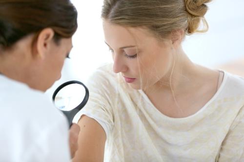 Urticaria solară (alergia la soare): cum se manifestă și cum poate fi prevenită?