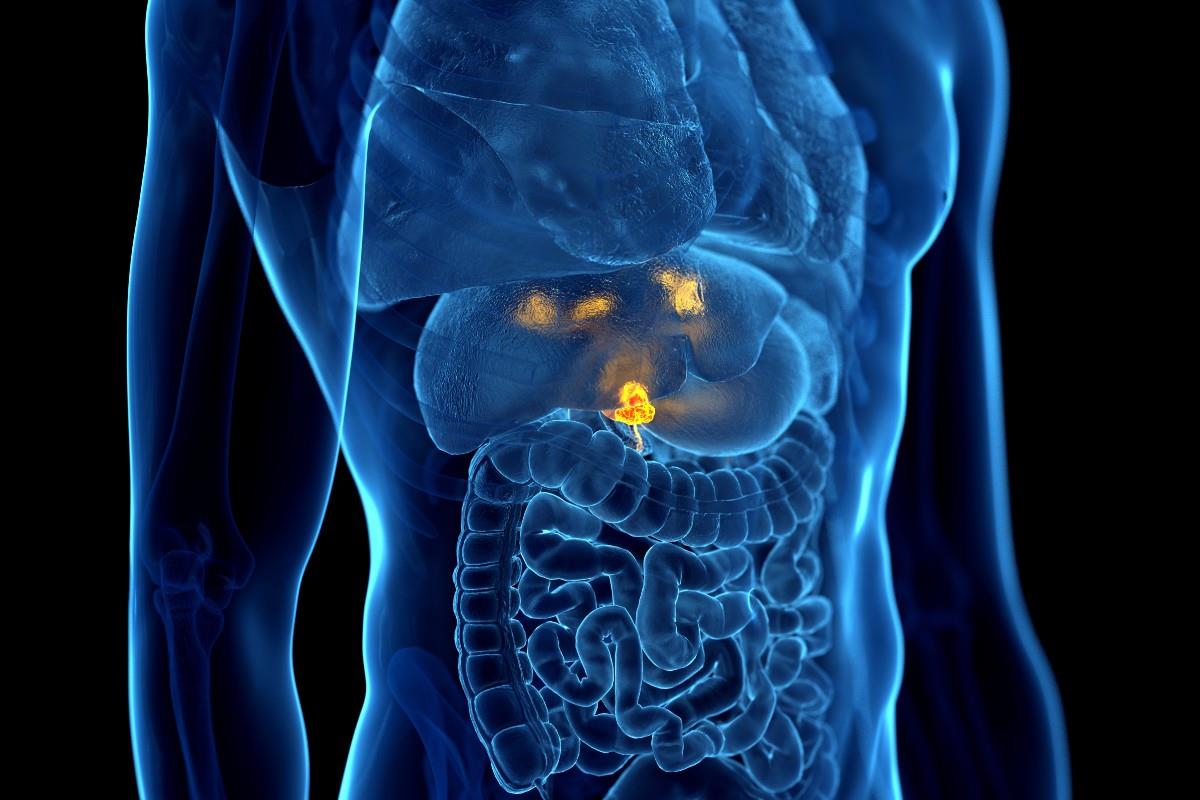 Tumorile cailor biliare – cauze, simptome, diagnostic, tratament