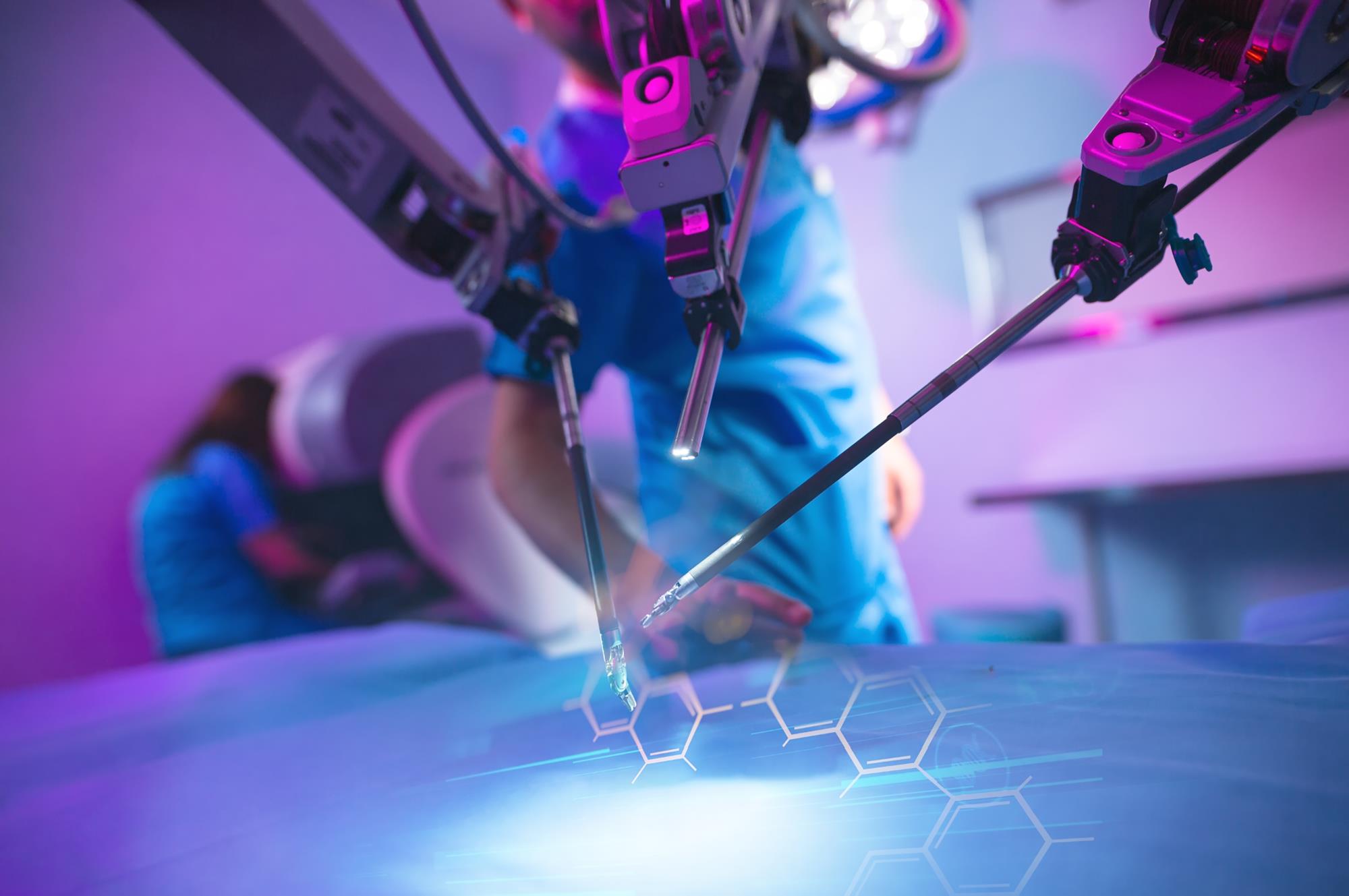Fibrom uterin, interventie chirurgicala inovatoare, miomectomie robotica da Vinci xi 