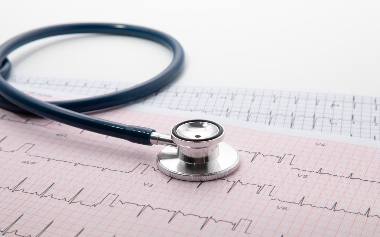 EKG, Electrocardiograma