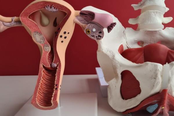 RMN pelvis (pelvin)