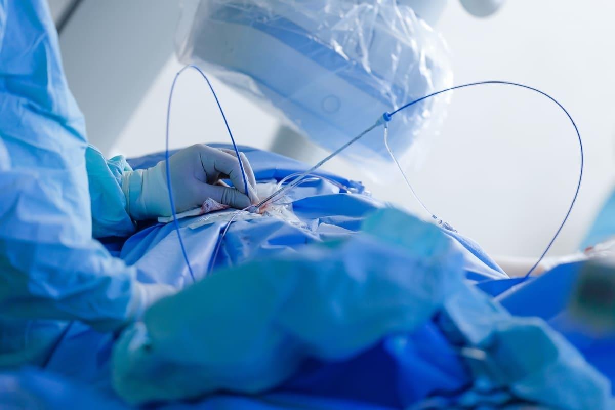 Cateterism cardiac: când este indicat, avantaje și riscuri